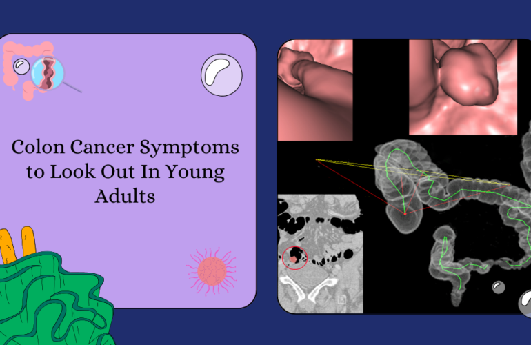 Symptoms of colon cancer in young adults