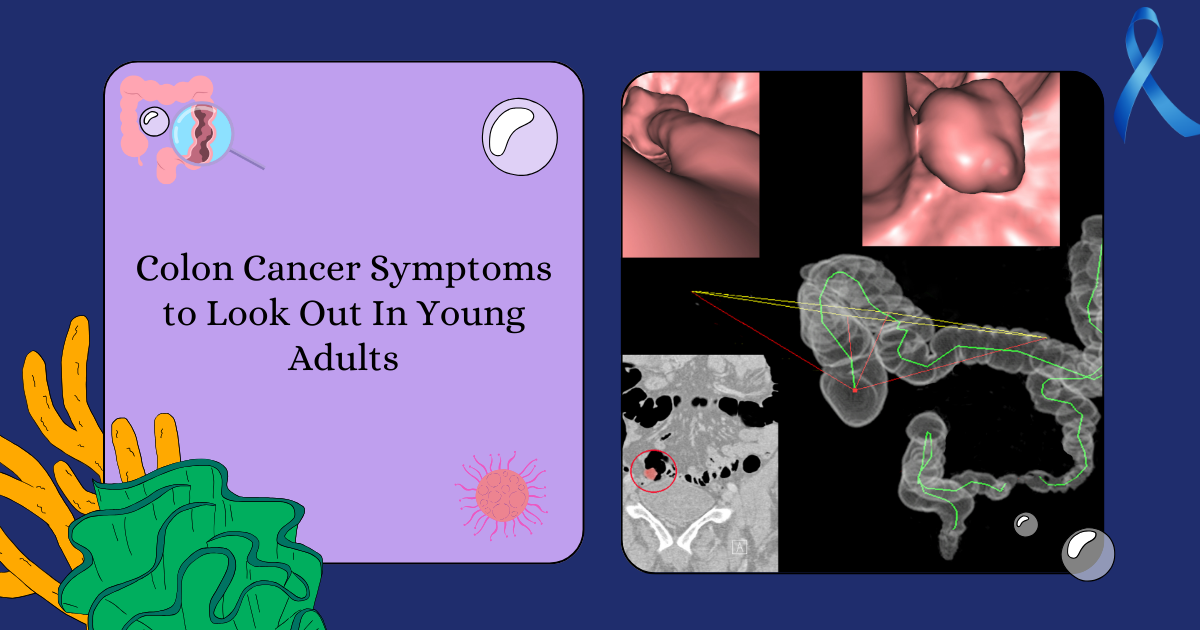 Symptoms of colon cancer in young adults