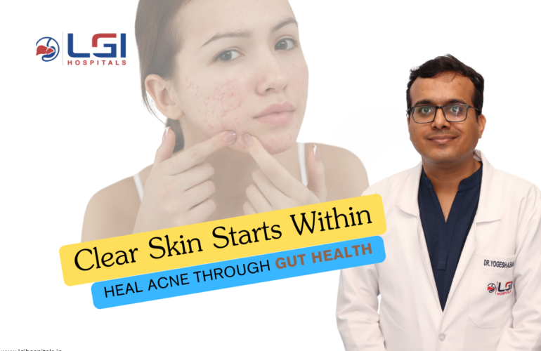 gut health and acne