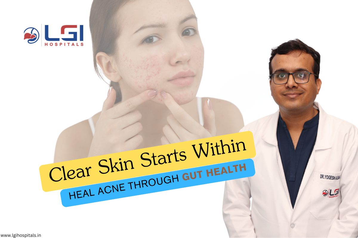 gut health and acne