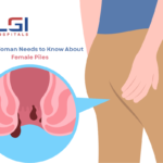 female piles