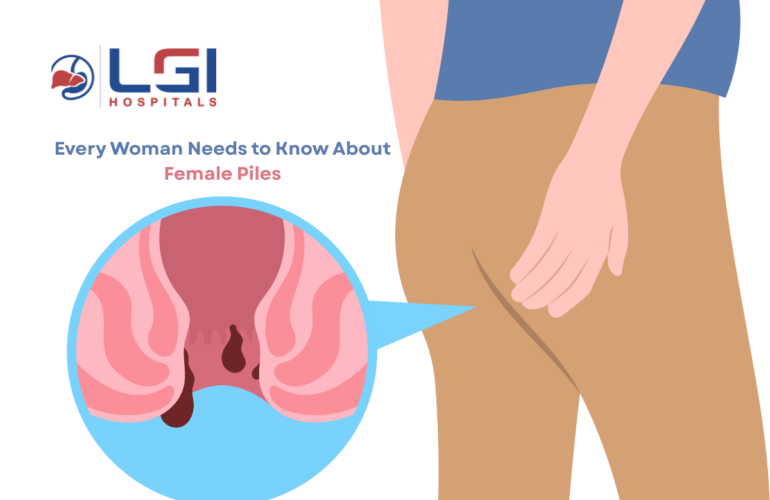female piles
