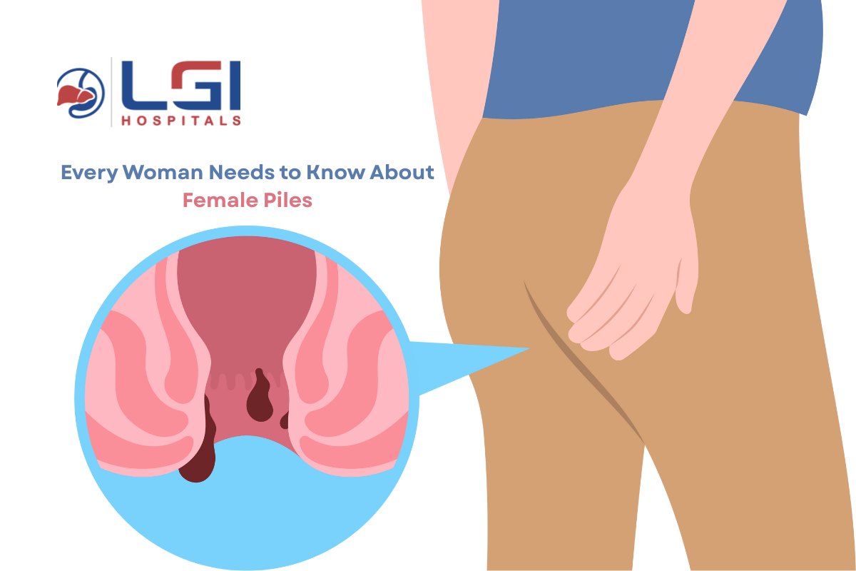 female piles