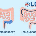 Sigmoidoscopy-vs-Colonoscopy