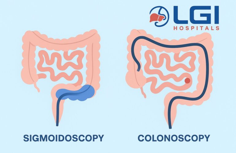Sigmoidoscopy-vs-Colonoscopy