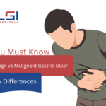 Benign vs Malignant Gastric Ulcer