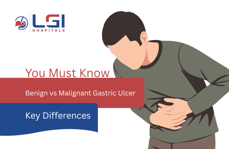 Benign vs Malignant Gastric Ulcer