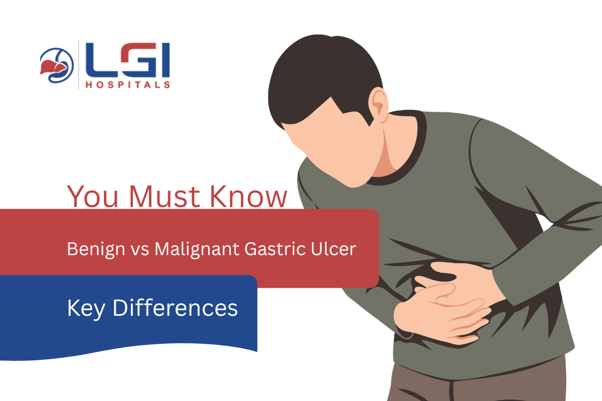 Benign vs Malignant Gastric Ulcer