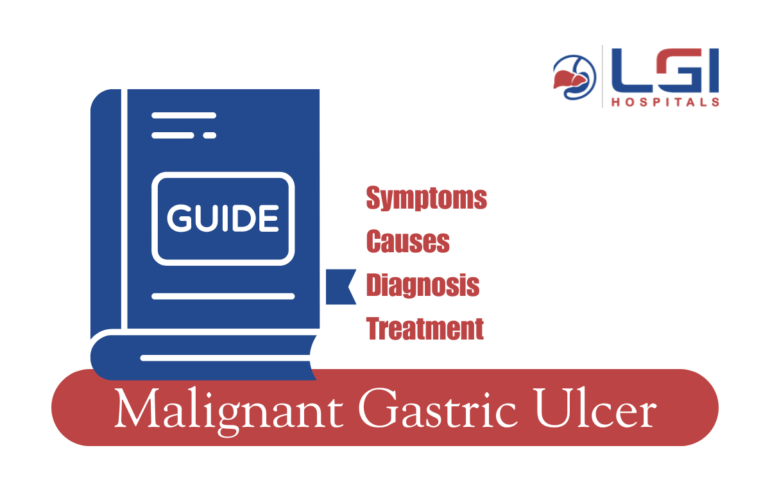 Malignant Gastric Ulcer