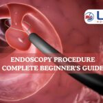 Endoscopy Procedure