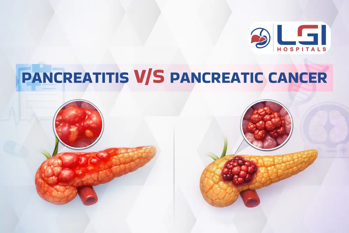 pancreas diseases and pancreatic cancer