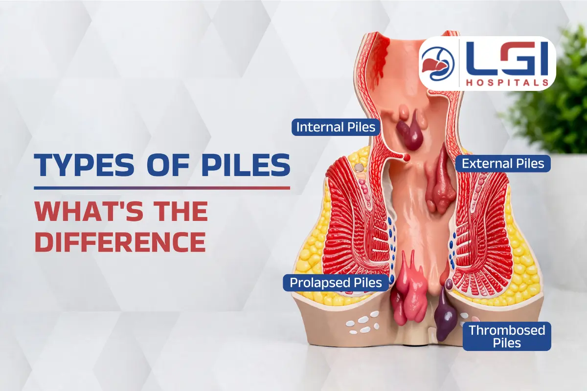 types of piles