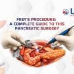 Frey-Procedure