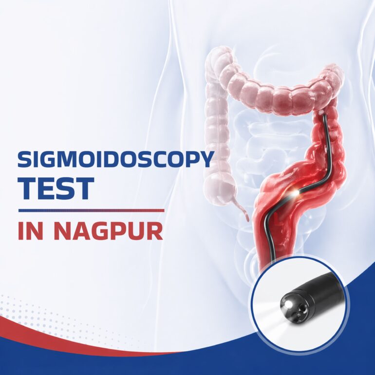 Normal Sigmoidoscopy Sigmoidoscopy Test in Nagpur | LGI Hospital