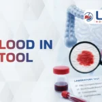 blood in stool