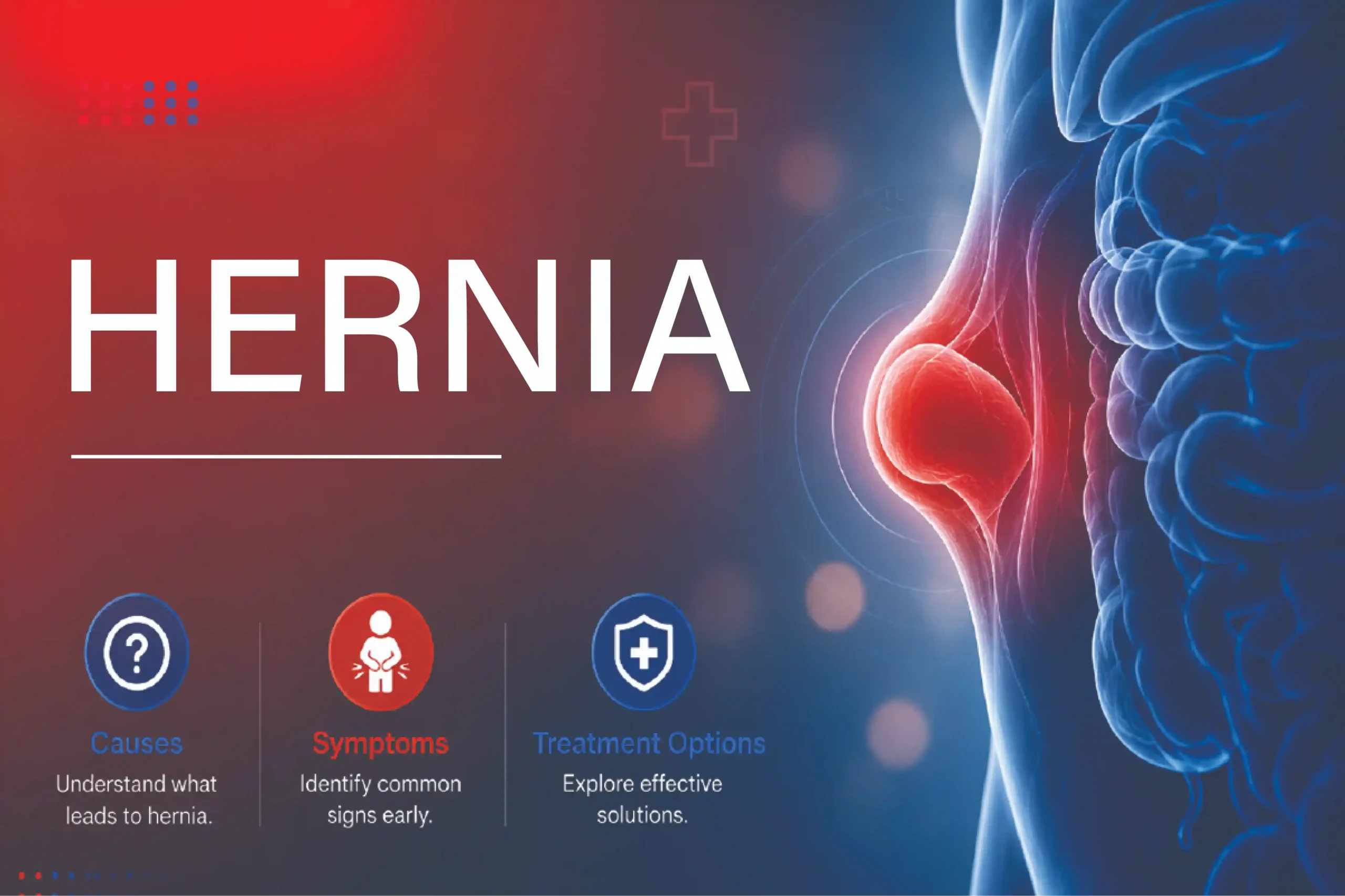 Hernia