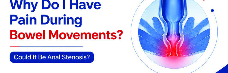 Pain During Bowel Movements