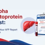 Alpha Fetoprotein Test