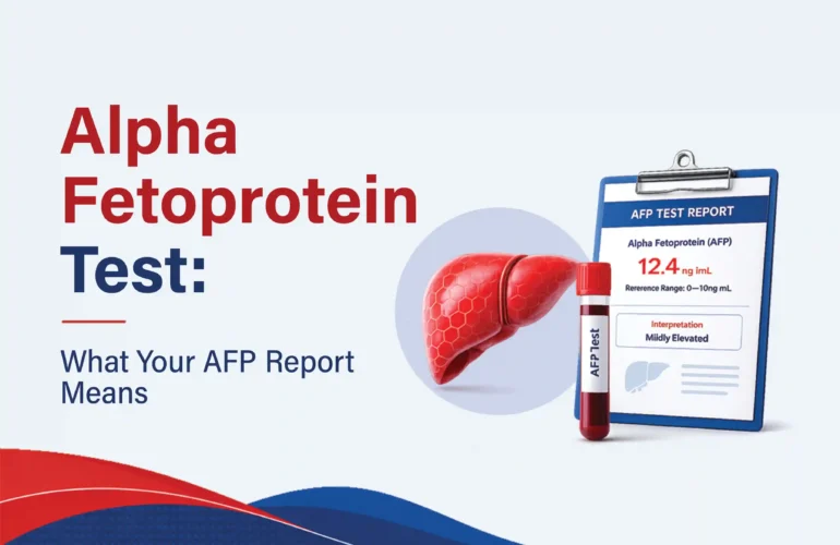 Alpha Fetoprotein Test