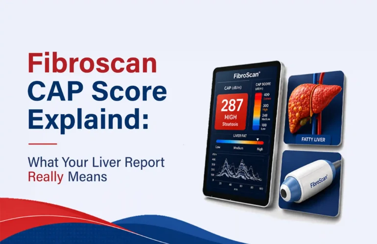 fibroscan cap score