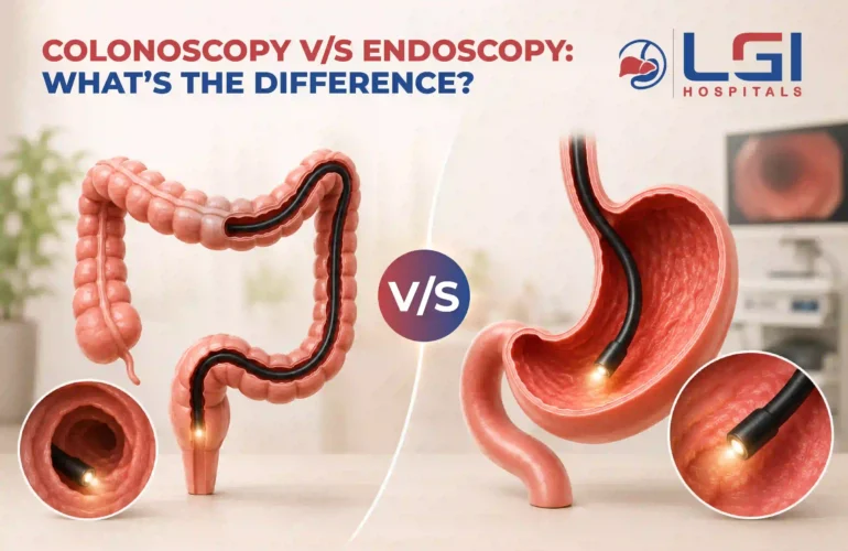 Colonoscopy Vs Endoscopy