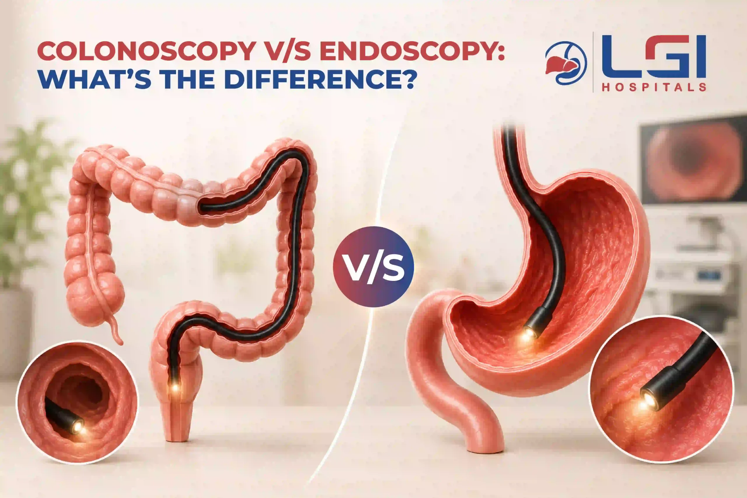 Colonoscopy Vs Endoscopy