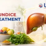 Jaundice Treatment