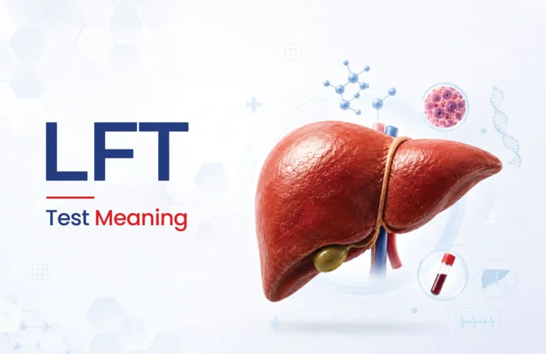 LFT Test Meaning