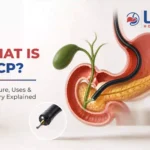 What is ERCP