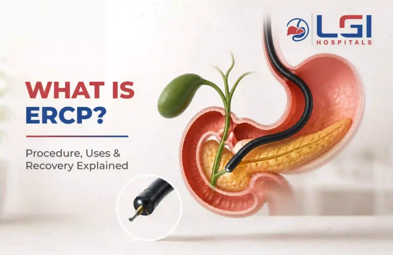 What is ERCP