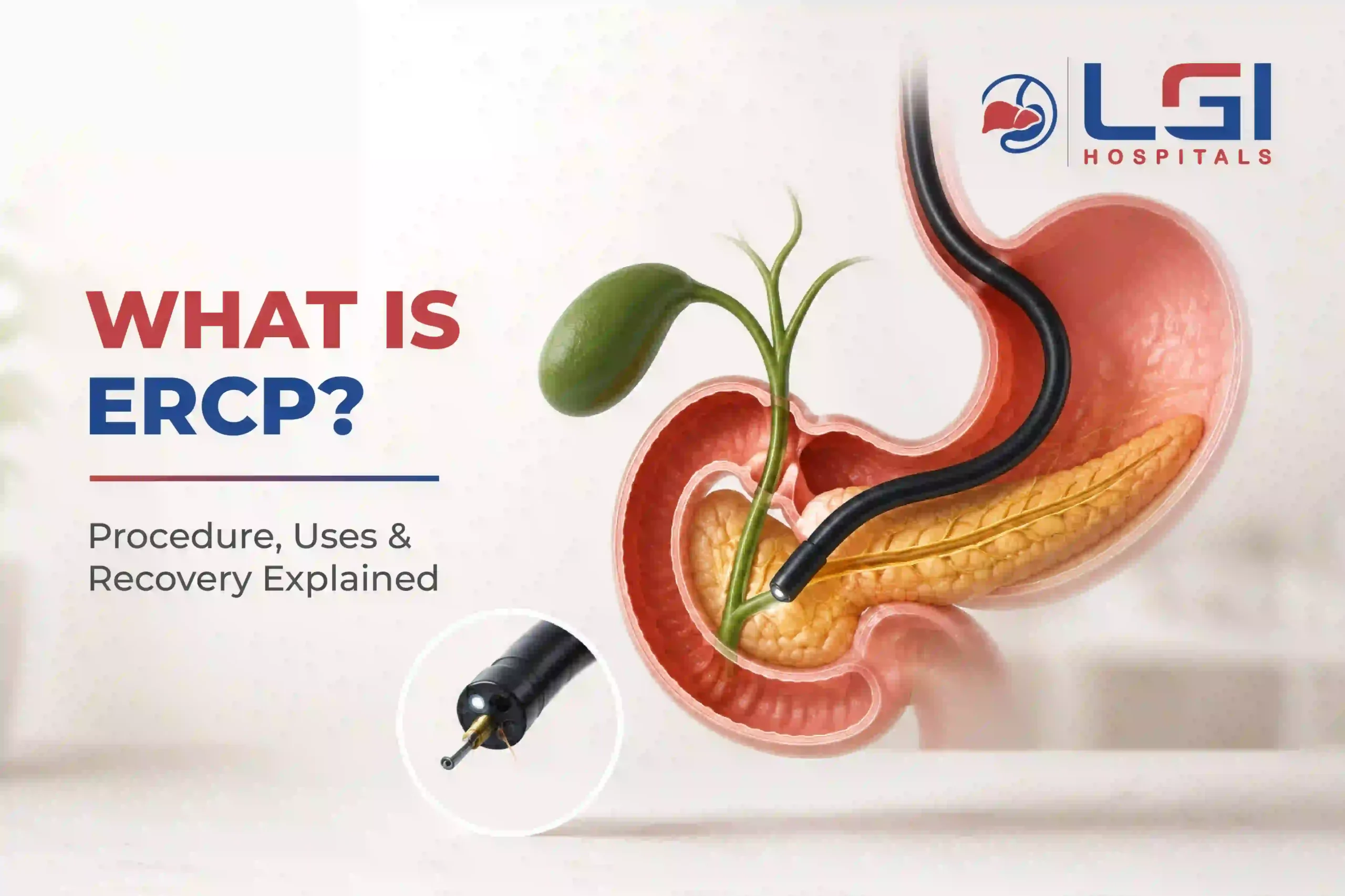 What is ERCP