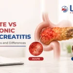Acute vs Chronic Pancreatitis