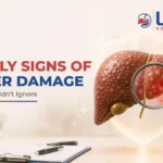 Early signs of liver damage