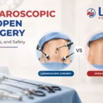laparoscopic vs open surgery