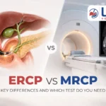 ERCP vs MRCP comparison showing endoscopic and MRI procedures for bile duct and pancreatic duct evaluation.