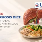 Liver cirrhosis diet infographic featuring a healthy meal, liver illustration