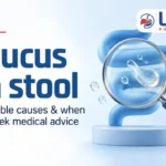 mucus in stool